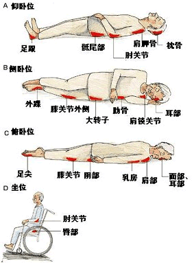 16.压疮的易发部位不包括