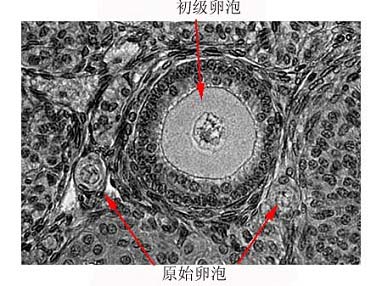 宫颈黏液出现羊齿状结晶 图片
