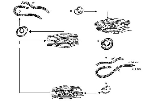 19.如图所示,下列关于旋毛虫病的病原学特点的描述,正确的是